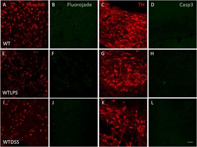 Galectin-3 Deletion Reduces LPS and Acute Colitis-Induced Pro-Inflammatory Microglial Activation in the Ventral Mesencephalon